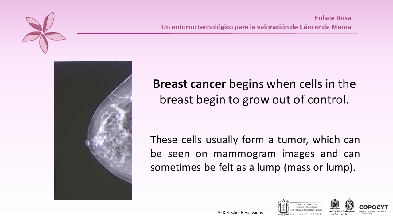 Infografía 2 - Enlace Rosa